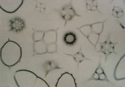 Conventional Phase Contrast