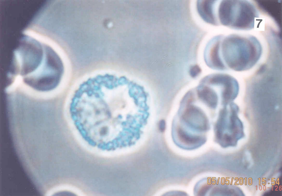 Blood samples 40x Phase contrast - Monocyte / Granulocyte